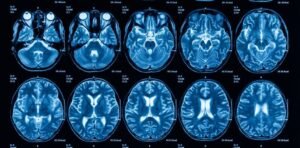 Burnout não é cansaço: o que a neurociência e a psicologia organizacional revelam sobre o esgotamento ocupacional moderno